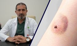 Erzincan'da Bu Sezon 9 Kişiye KKKA Tanısı Konuldu