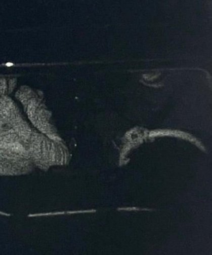 Gülistan Doku Soruşturmasında PTS Kayıtları Ortaya Çıktı