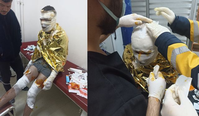 Erzurum'da Kömür Ocağında Yangın: 2 İşçi Yaralı